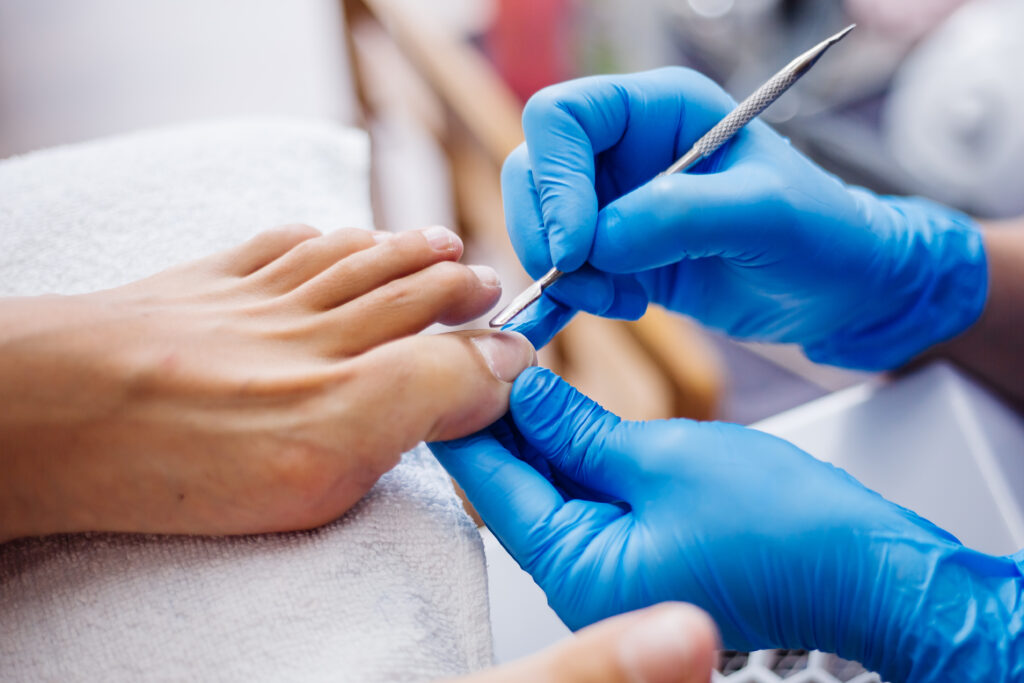 Tratamiento de podología en Lahera Salud